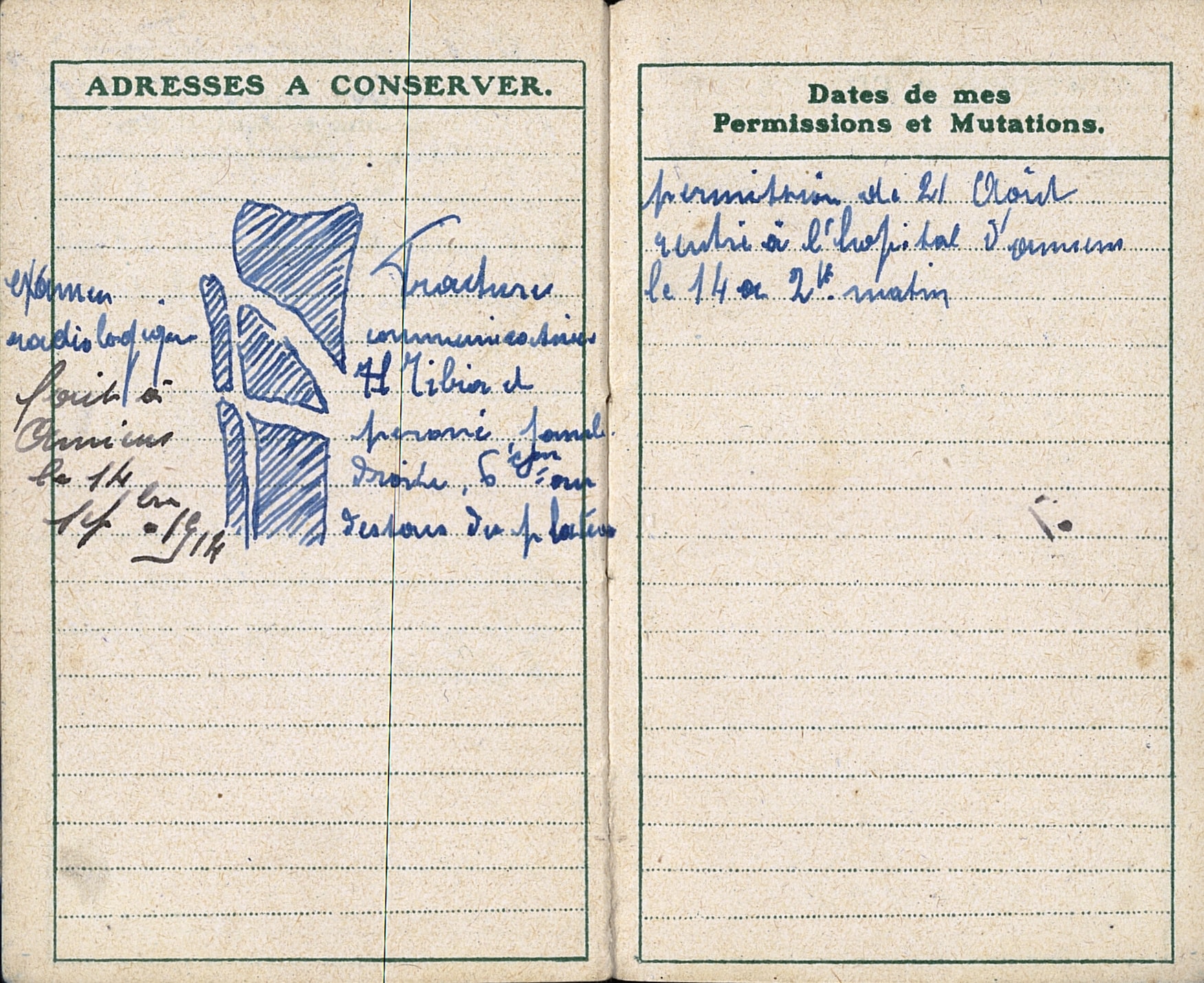 Description d’une fracture. Carnet de Maxime Petit, 169e RI, blessé et amputé de la jambe gauche le 13 septembre 1916. Archives nationales, 700AP/13/PA_301