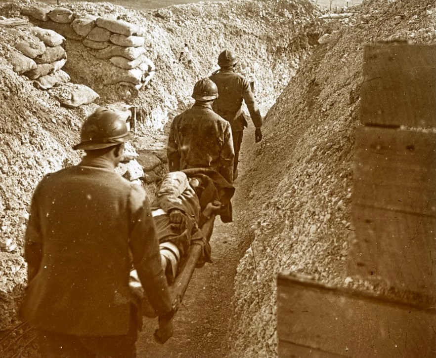 Évacuation d’un blessé dans un boyau sur le front de Champagne. Collection de plaques de verre stéréoscopiques de Maurice Brun, musicien au 89e RI. Sans date. Archives nationales, 700AP/13/PA_341/1